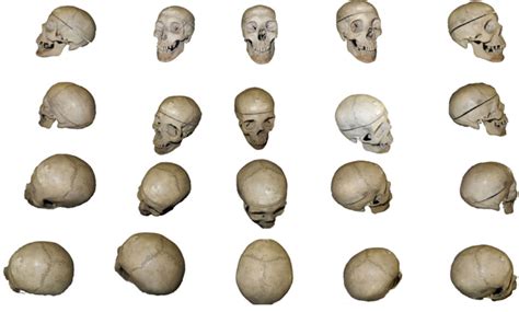 Pictures Of The Same Skull From Different Angles This Kind Of