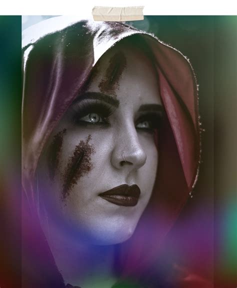 Cara Menghilangkan Bekas Cupang Dalam 1 Jam