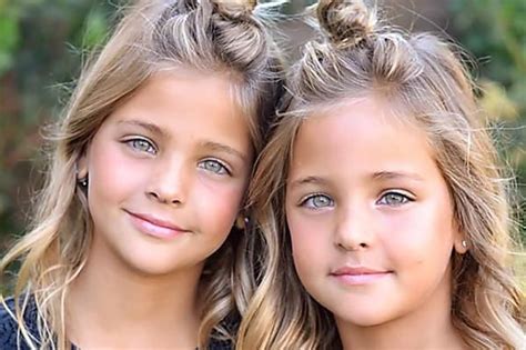 [gallery] these twins were named most beautiful in the world wait till you see them today