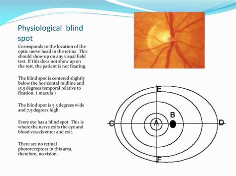 Where Is The Blind Spot Of The Eye Located Blinds