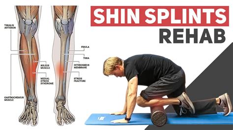 3 Exercises For Anterior Shin Splints Youtube
