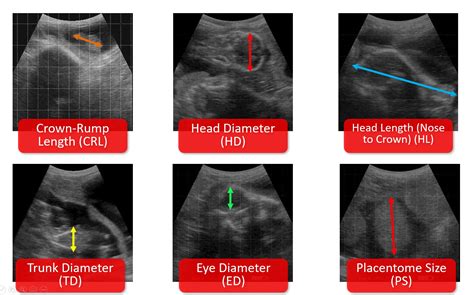 Ultrasound Scanning Ageing The Bovine Foetus Veterinary Practice