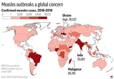 Measles Outbreak How Many Cases Have Hit The Us And Why Has Pa Been