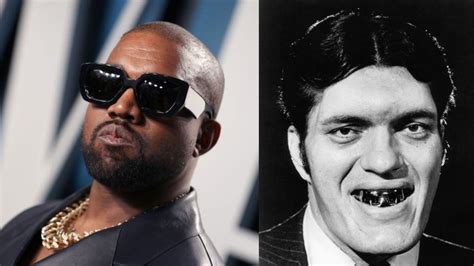 Kanye Wests Teeth Now Titanium Dentures Worth 850k Report