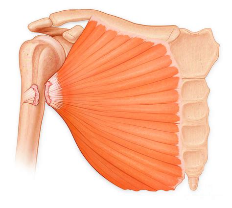 Related online courses on physioplus. Pectoralis Major Tear Syndrome Photograph by Medical Imagery Studios/design Pics/science Photo ...