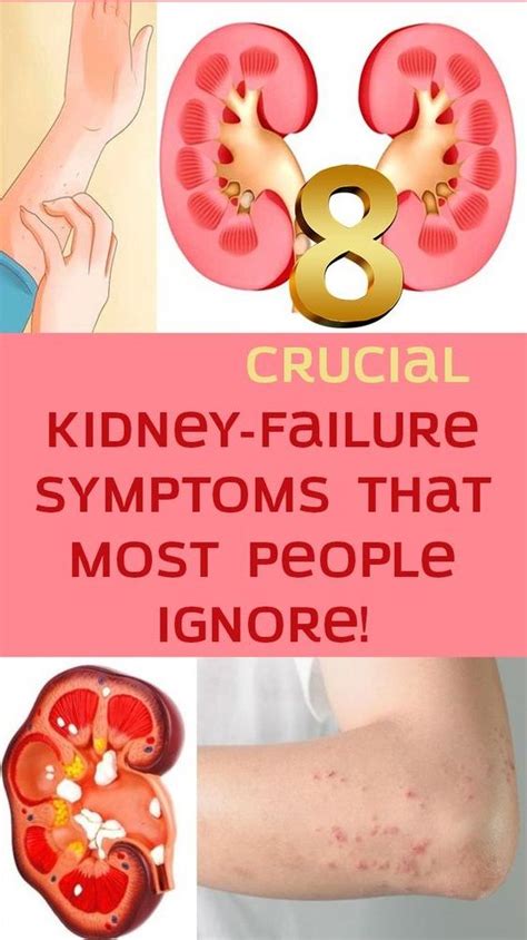 Best 50 Pictures Of Where Kidneys Are Located Cool Wallpaper