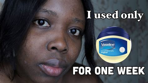I Used Only Vaseline On My Face Everyday For 7 Days And This Is What