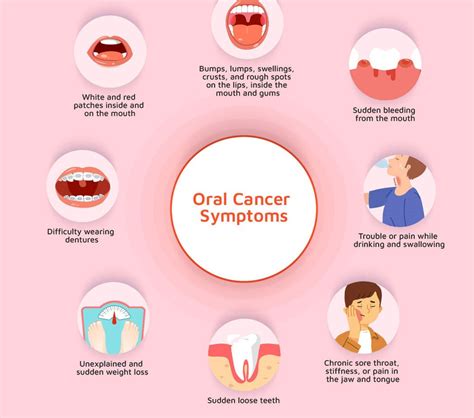 Oral Cancer Lip
