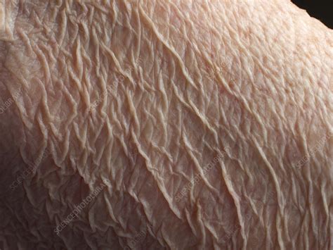 Wrinkly Skin Of An Old Woman Stock Image C Science Photo