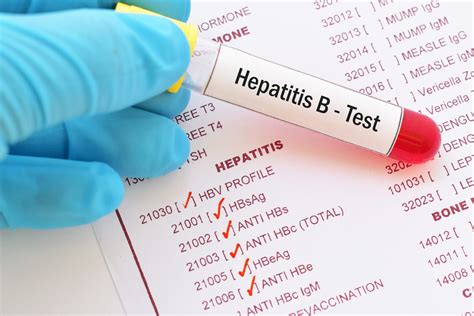 Viral hepatitis b and c: Coding Hepatitis B Screening: How to Ensure Reimbursement - AAPC Knowledge Center