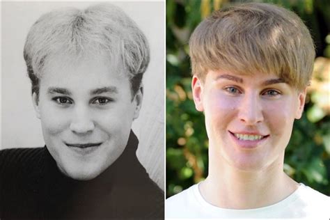 Tobias Strebel Who Underwent Plastic Surgery To Look Like Justin
