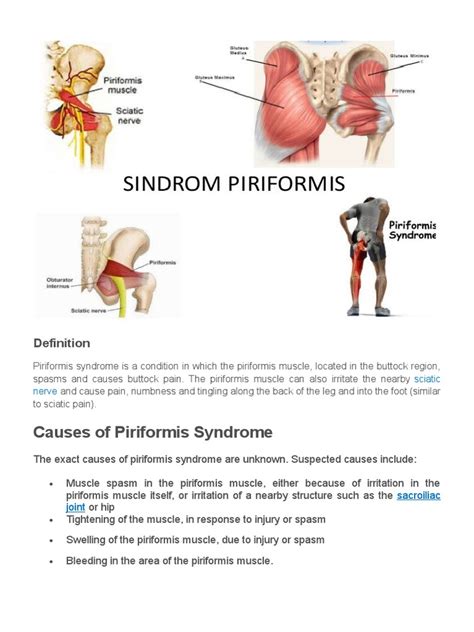 Piriformis Syndrome Musculoskeletal System Clinical Medicine