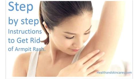 Step By Step Instructions To Get Rid Of Armpit Rash Armpit Rash Healthy Skin Cream Armpits