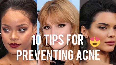 10 Tips For Preventing Acne Youtube