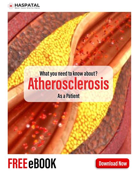 How Atherosclerosis Can Affect Your Health Haspatal Online Consultation App Haspatal｜easy