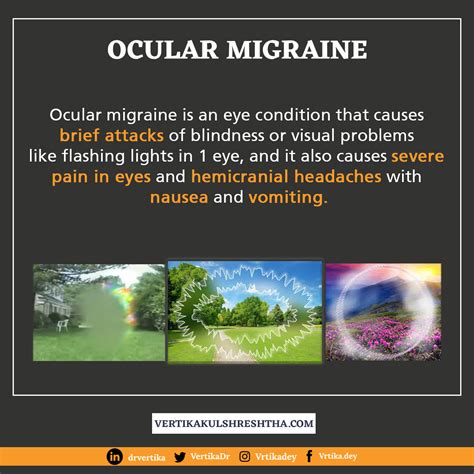Ocular Migraine Dr Vertika Kulshrestha Eye Specialist