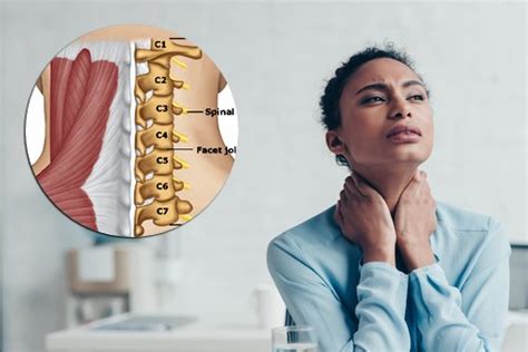 Cervical Strain A Common Initial Diagnosis For Neck Pain