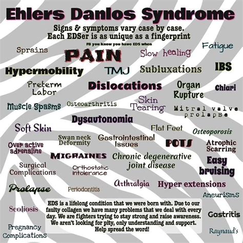 691 Best Ehlers Danlos Syndrome Images On Pinterest Ehlers Danlos