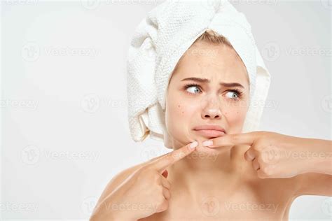 Woman With A Towel On Her Head Squeezes Out Pimples On Her Face Clean