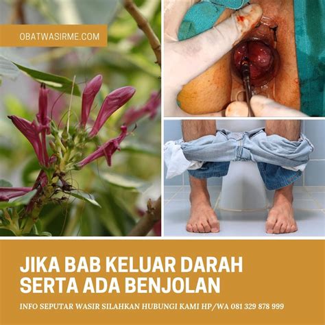 Ambeien Dalam Serta Cara Menghilangkannya Secara Alami Dan Efektif Dengan Gambar Alam Jeruk