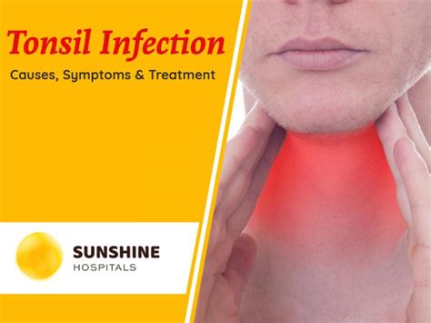 Tonsil Infection Causes Symptoms Treatment Multispeciality Hospital