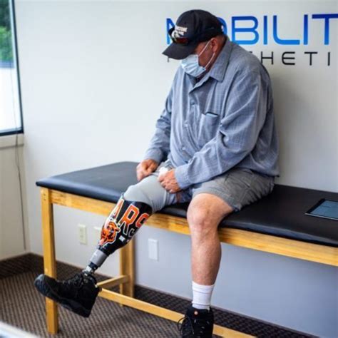 Prosthetic Utah Company Mobility Prosthetics Salt Lake City