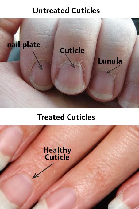 How To Care For Your Cuticles A Step By Step Guide To Maintaining