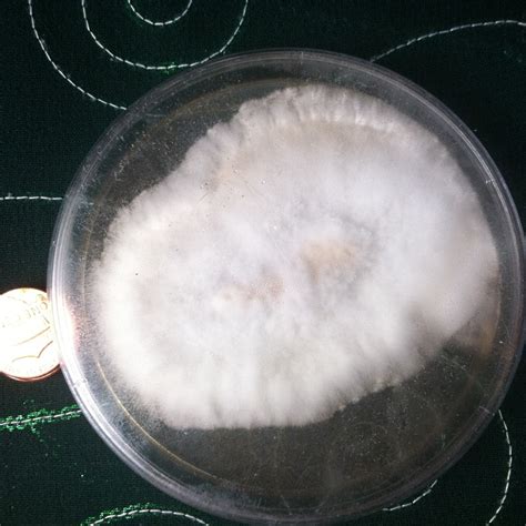 Agar Tomentose Mycelium Or Contam Mushroom Cultivation Shroomery