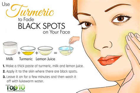 Home Remedies For Black Spots On Face Top 10 Home Remedies