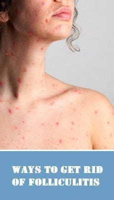 Touching or scratching your face can transfer bacteria to your vulnerable skin, leading to breakouts and infection. Folliculitis, an inflammation or infection of the hair ...