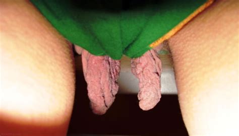 Huge Labia In Panties XXGASM