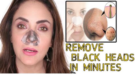 Home Made Blackheads Removing Strip Remove From Nose Instantly Youtube