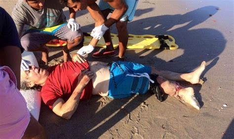 【閲覧注意】海水浴場で男性がワニに襲われ危険な状態。写真がヤバい ポッカキット