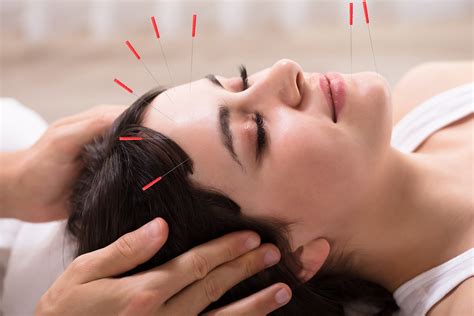 Cosmetic Acupuncture Facial Acupuncture For Wrinkles Who Magazine