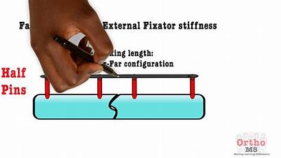 Fixator External Stiffness Increasing
