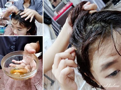 Oh Fish Iee Review Scalp Check And Treatment At Miracle Hair Expert