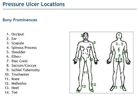 Pressure Ulcer Sites Diagram