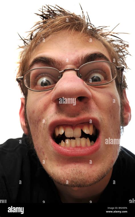 Angry Ugly Man With Crooked Teeth And Glasses Isolated On White Stock