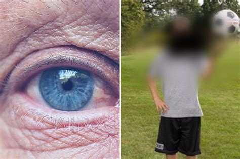 Macular Degeneration Symptoms Causes And Treatment College Review