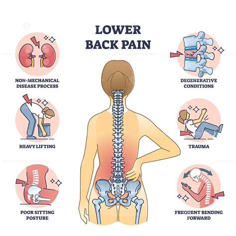Lower Back Pain And Painful Body Backbone Skeleton Causes Outline