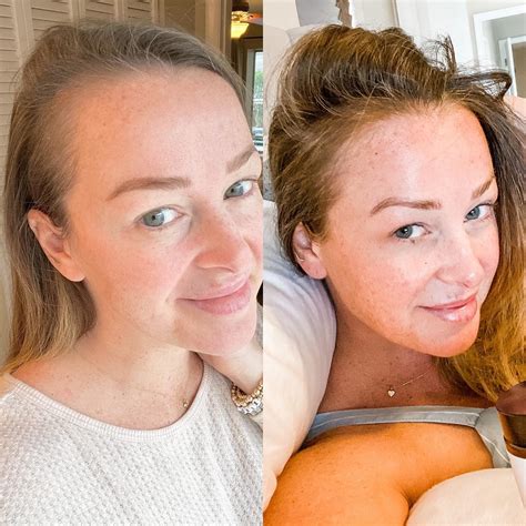 Beautiful Before And After But Not Jamie Otis Official