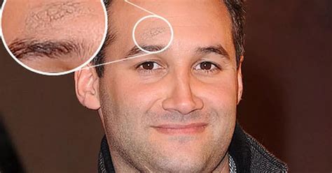 Celebrity Big Brother Dane Bowers Fails To Cover Bruise After Fight At Jordan And Alex Reids