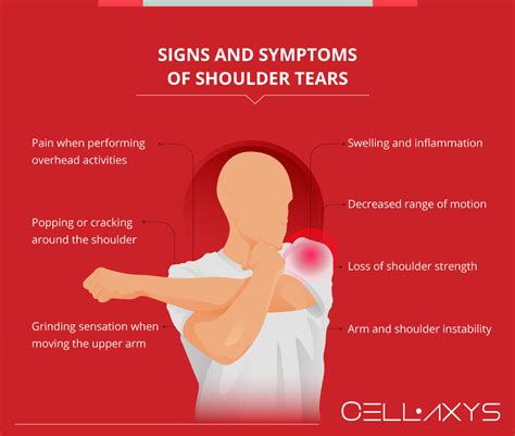 Shoulder Labrum Tears Treatment And Diagnosis Cellaxys