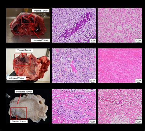 Patient Matched Gross Pathology And Microscopic Histology Images