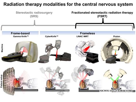 Radiation Therapy Modalities For The Central Nervous System Nicholas