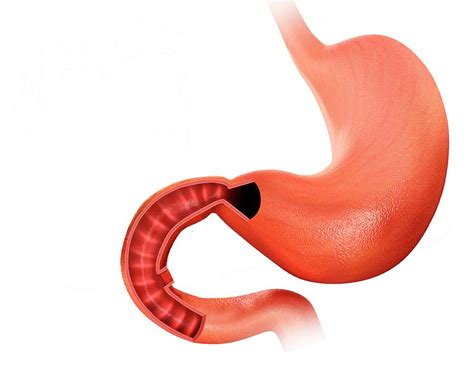 Small Intestine And Stomach Photograph By Pixologicstudio