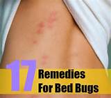 Pictures of Treatment For Bed Bugs Home Remedies