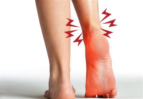 Podiatrists For Achilles Tendonitis In Varsity Calgary