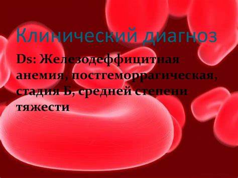 Анемия постгеморрагическая диета Клинический случай. Железодеффицитная анемия, постгеморрагическая Клинический случай. Железодеффицитная анемия, постгеморрагическая Анемия постгеморрагическая диета