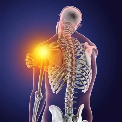 Shoulder Pain Conceptual 3d Illustration Showing Human Male Body With